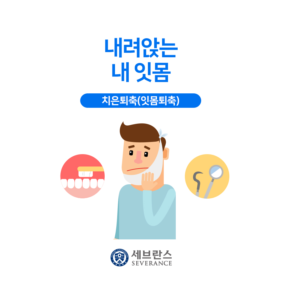 내려앉는 내 잇몸 – 치은퇴축