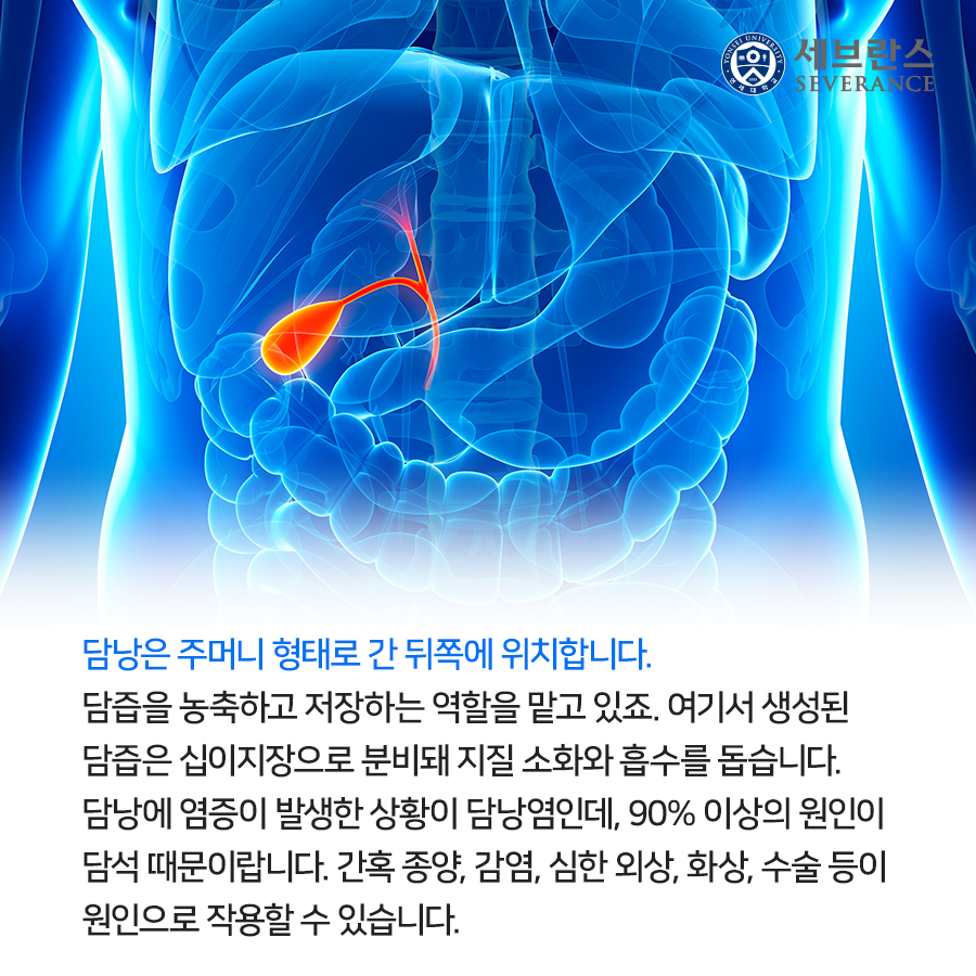담낭은 주머니 형태로 간 뒤쪽에 위치합니다. 담즙을 농축하고 저장하는 역할을 맡고 있죠. 여기서 생성된 담즙은 십이지장으로 분비돼 지질 소화와 흡수를 돕습니다. 담낭에 염증이 발생한 상황이 담낭염인데, 90% 이상의 원인이 담석 때문이랍니다. 간혹 종양, 감염, 심한 외상, 화상, 수술 등이 원인으로 작용할 수 있습니다.