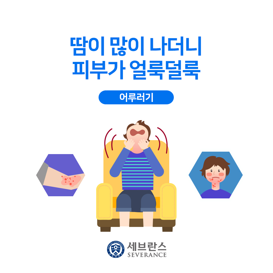 땀이 많이 나더니 피부가 얼룩덜룩 - 어루러기