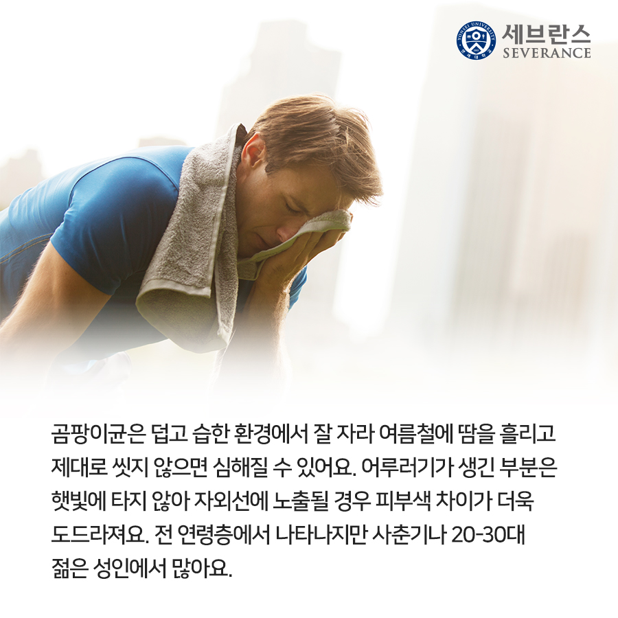 곰팡이균은 덥고 습한 환경에서 잘 자라 여름철에 땀을 흘리고 제대로 씻지 않으면 심해질 수 있어요.  어루러기가 생긴 부분은 햇빛에 타지 않아 자외선에 노출될 경우 피부색 차이가 더욱 도드라져요.  전 연령층에서 나타나지만 사춘기나 20-30대 젊은 성인에서 많아요.