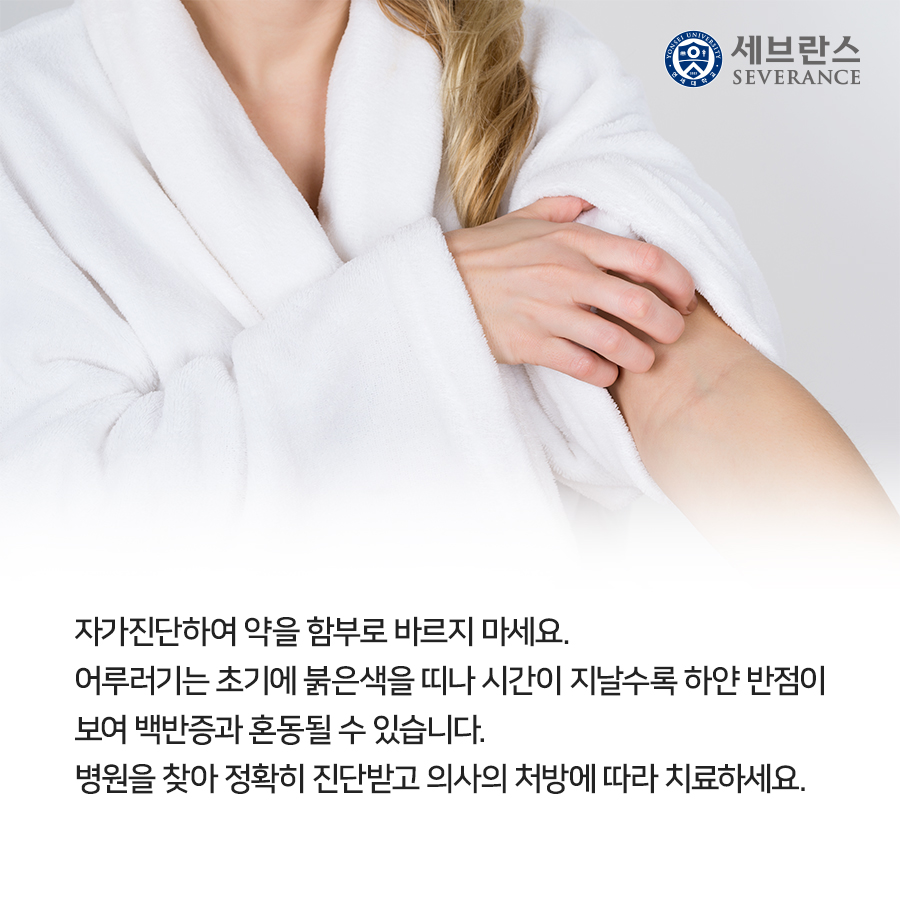 자가진단하여 약을 함부로 바르지 마세요.  어루러기는 초기에 붉은색을 띠나 시간이 지날수록 하얀 반점이 보여 백반증과 혼동될 수 있습니다.  병원을 찾아 정확히 진단받고 의사의 처방에 따라 치료하세요.