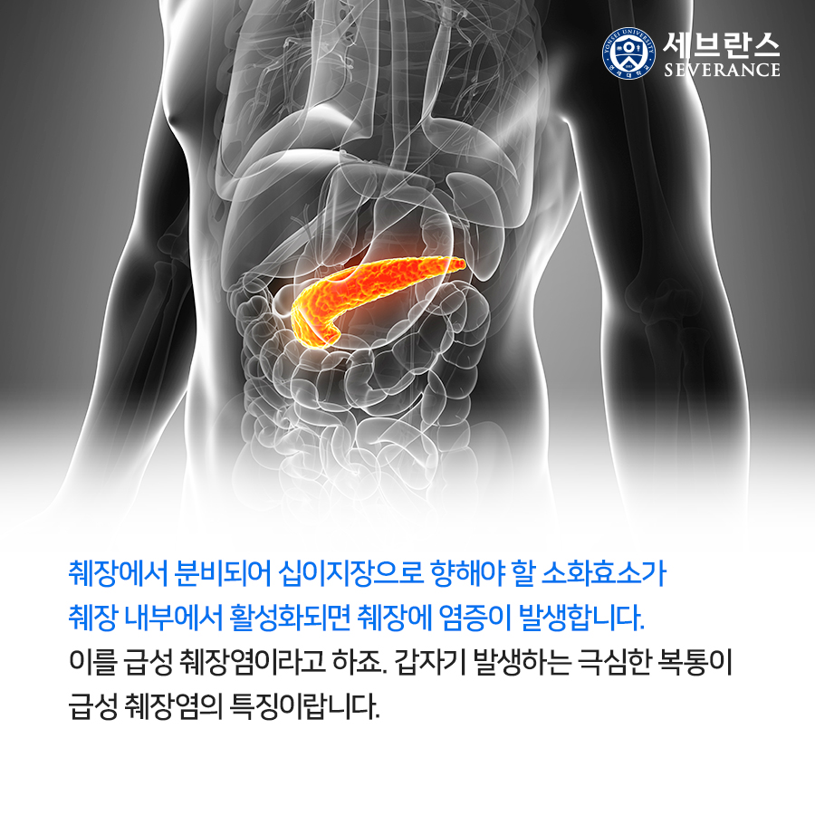 췌장에서 분비되어 십이지장으로 향해야 할 소화효소가 췌장 내부에서 활성화되면 췌장에 염증이 발생합니다. 이를 급성 췌장염이라고 하죠. 갑자기 발생하는 극심한 복통이 급성 췌장염의 특징이랍니다.