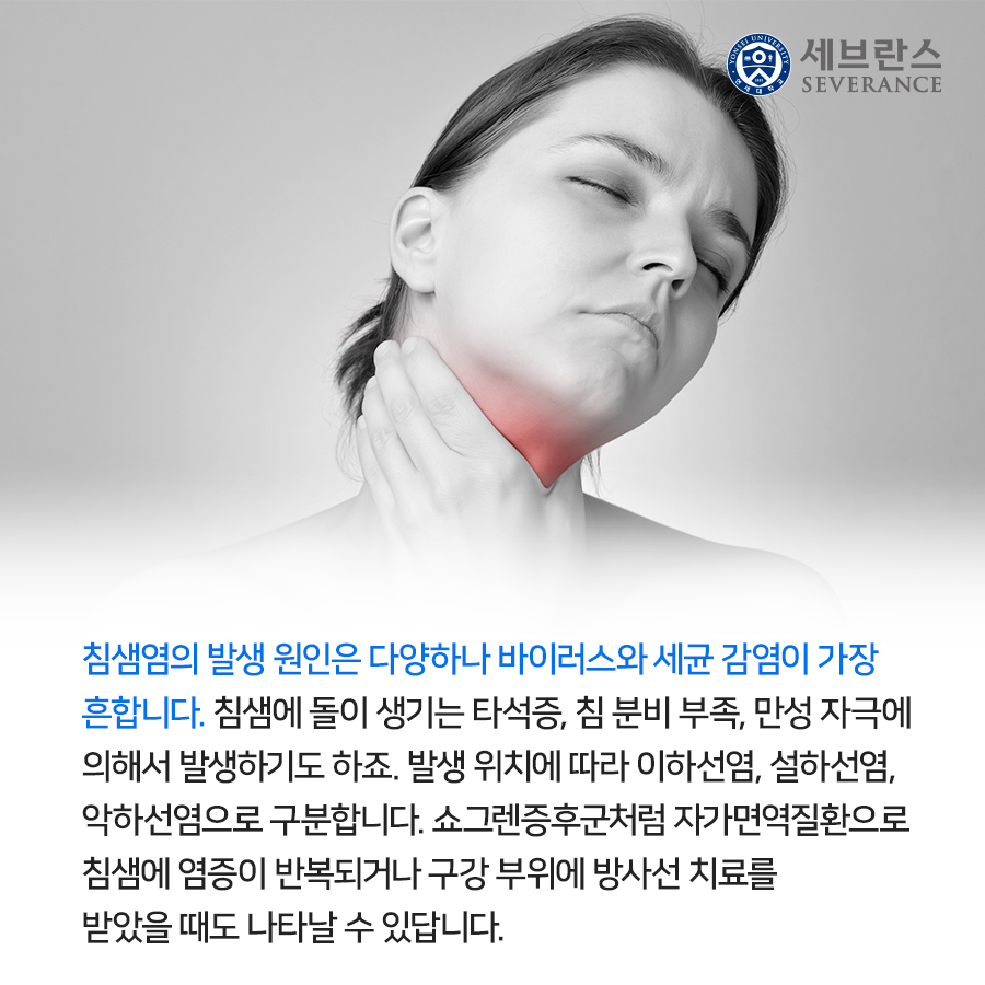 침샘염의 발생 원인은 다양하나 바이러스와 세균 감염이 가장 흔합니다. 침샘에 돌이 생기는 타석증, 침 분비 부족, 만성 자극에 의해서 발생하기도 하죠. 발생 위치에 따라 이하선염, 설하선염, 악하선염으로 구분합니다. 쇼그렌증후군처럼 자가면역질환으로 침샘에 염증이 반복되거나 구강 부위에 방사선 치료를 받았을 때도 나타날 수 있답니다.