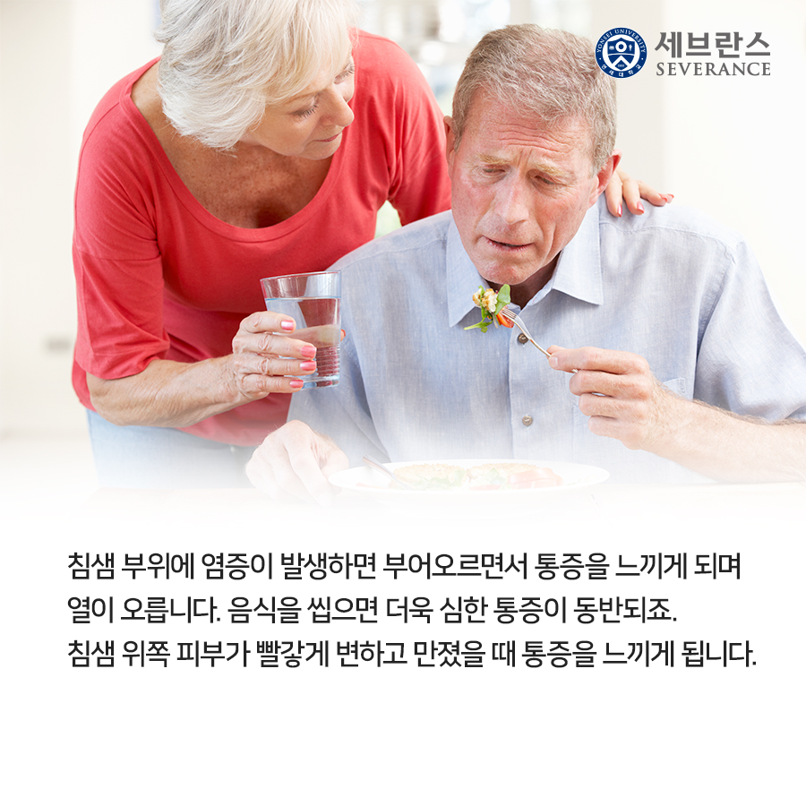 침샘 부위에 염증이 발생하면 부어오르면서 통증을 느끼게 되며 열이 오릅니다. 음식을 씹으면 더욱 심한 통증이 동반되죠. 침샘 위쪽 피부가 빨갛게 변하고 만졌을 때 통증을 느끼게 됩니다.