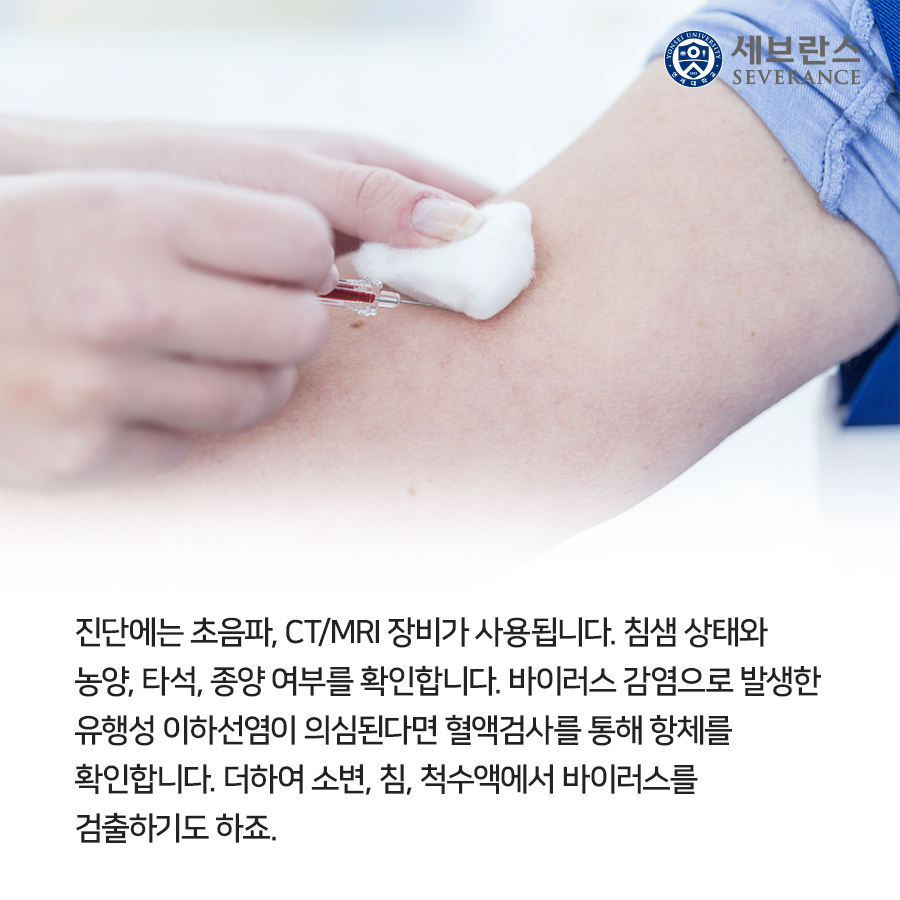 진단에는 초음파, CT/MRI 장비가 사용됩니다. 침샘 상태와 농양, 타석, 종양 여부를 확인합니다. 바이러스 감염으로 발생한 유행성 이하선염이 의심된다면 혈액검사를 통해 항체를 확인합니다. 더하여 소변, 침, 척수액에서 바이러스를 검출하기도 하죠.
