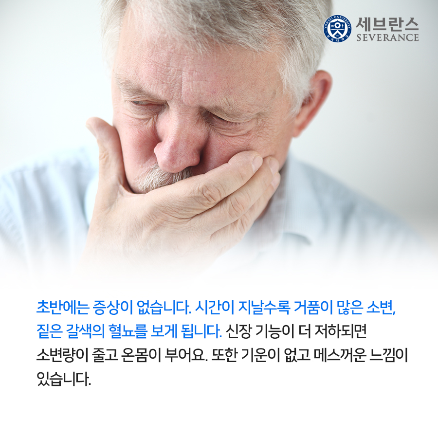 초반에는 증상이 없습니다. 시간이 지날수록 거품이 많은 소변, 짙은 갈색의 혈뇨를 보게 됩니다. 신장 기능이 더 저하되면 소변량이 줄고 온몸이 부어요. 또한 기운이 없고 메스꺼운 느낌이 있습니다. 