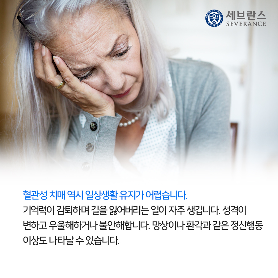 혈관성 치매 역시 일상생활 유지가 어렵습니다. 기억력이 감퇴하며 길을 잃어버리는 일이 자주 생깁니다. 성격이 변하고 우울해하거나 불안해합니다. 망상이나 환각과 같은 정신행동 이상도 나타날 수 있습니다.