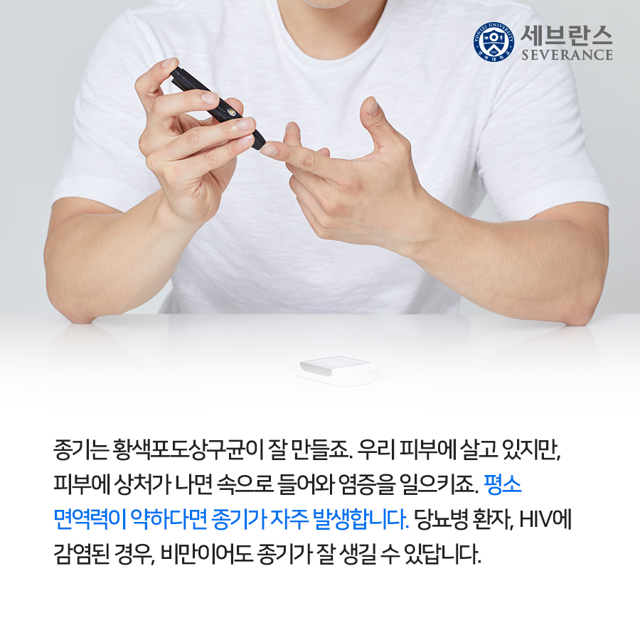 종기는 황색포도상구균이 잘 만들죠. 우리 피부에 살고 있지만, 피부에 상처가 나면 속으로 들어와 염증을 일으키죠. 평소 면역력이 약하다면 종기가 자주 발생합니다. 당뇨병 환자, HIV에 감염된 경우, 비만이어도 종기가 잘 생길 수 있답니다. 