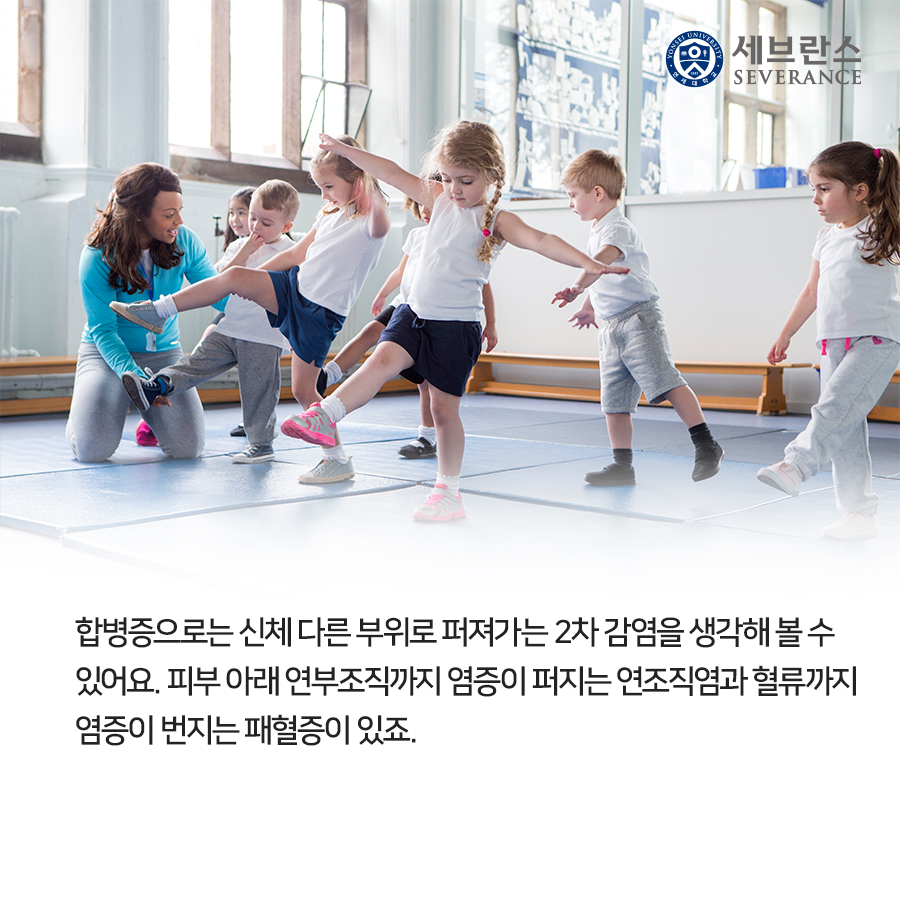 합병증으로는 신체 다른 부위로 퍼져가는 2차 감염을 생각해 볼 수 있어요. 피부 아래 연부조직까지 염증이 퍼지는 연조직염과 혈류까지 염증이 번지는 패혈증이 있죠.