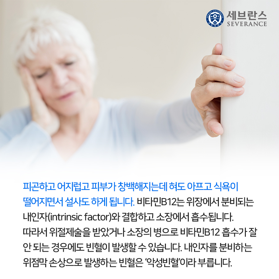 피곤하고 어지럽고 피부가 창백해지는데 혀도 아프고 식욕이 떨어지면서 설사도 하게 됩니다. 비타민B12는 위장에서 분비되는 내인자(intrinsic factor)와 결합하고 소장에서 흡수됩니다. 따라서 위절제술을 받았거나 소장의 병으로 비타민B12 흡수가 잘 안 되는 경우에도 빈혈이 발생할 수 있습니다. 내인자를 분비하는 위점막 손상으로 발생하는 빈혈은 ‘악성빈혈’이라 부릅니다.
