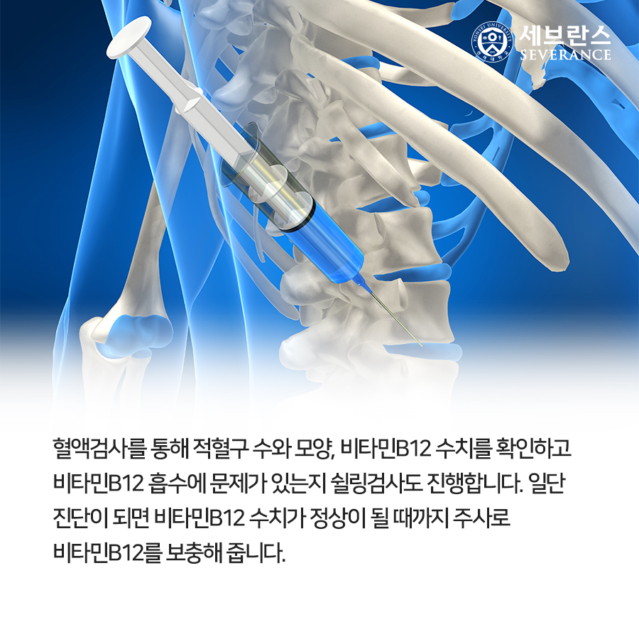 혈액검사를 통해 적혈구 수와 모양, 비타민B12 수치를 확인하고 비타민B12 흡수에 문제가 있는지 쉴링검사도 진행합니다. 일단 진단이 되면 비타민B12 수치가 정상이 될 때까지 주사로 비타민B12를 보충해 줍니다.