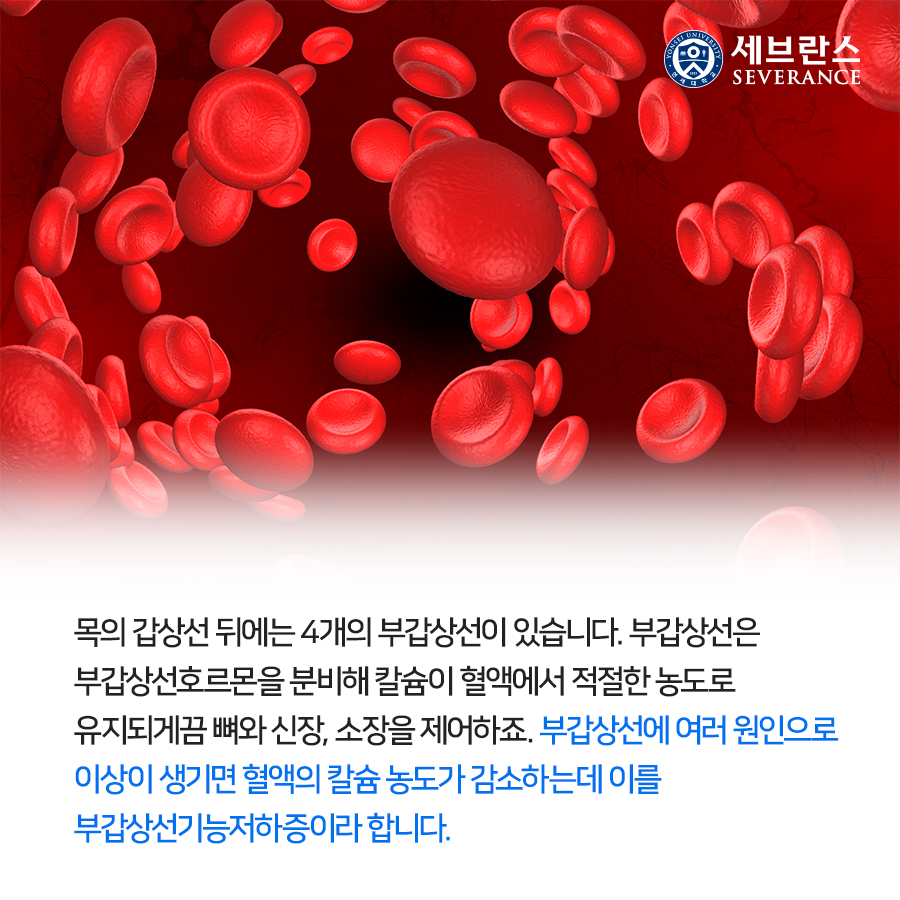 목의 갑상선 뒤에는 4개의 부갑상선이 있습니다. 부갑상선은 부갑상선호르몬을 분비해 칼슘이 혈액에서 적절한 농도로 유지되게끔 뼈와 신장, 소장을 제어하죠. 부갑상선에 여러 원인으로 이상이 생기면 혈액의 칼슘 농도가 감소하는데 이를 부갑상선기능저하증이라 합니다.