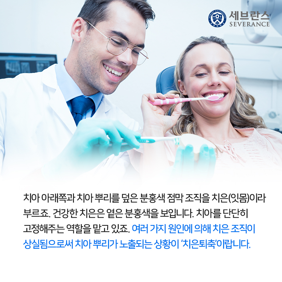 치아 아래쪽과 치아 뿌리를 덮은 분홍색 점막 조직을 치은(잇몸)이라 부르죠. 건강한 치은은 옅은 분홍색을 보입니다. 치아를 단단히 고정해주는 역할을 맡고 있죠. 여러 가지 원인에 의해 치은 조직이 상실됨으로써 치아 뿌리가 노출되는 상황이 ‘치은퇴축’이랍니다.