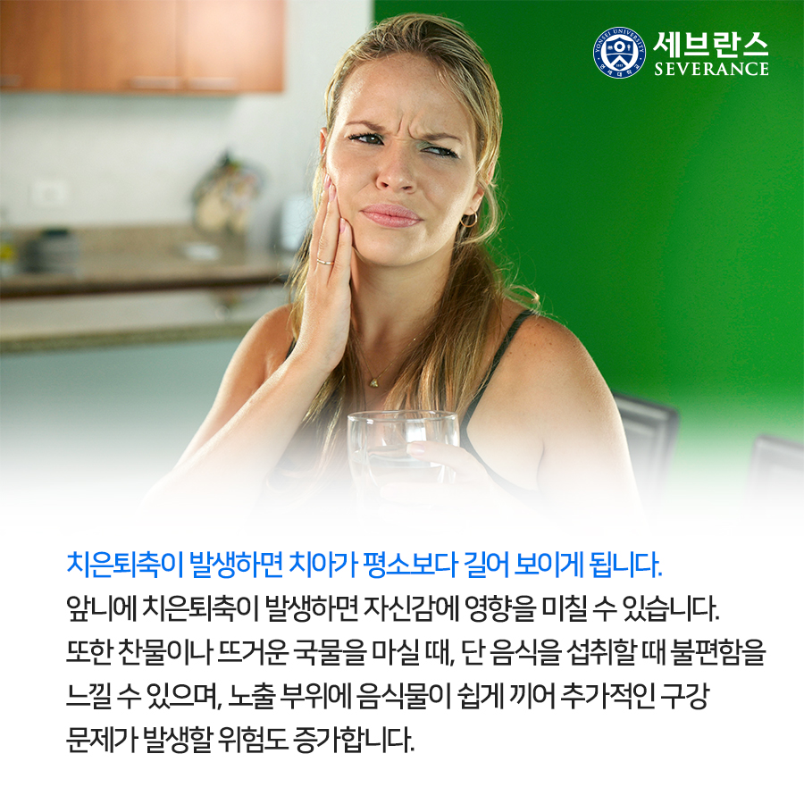 치은퇴축이 발생하면 치아가 평소보다 길어 보이게 됩니다. 앞니에 치은퇴축이 발생하면 자신감에 영향을 미칠 수 있습니다. 또한 찬물이나 뜨거운 국물을 마실 때, 단 음식을 섭취할 때 불편함을 느낄 수 있으며, 노출 부위에 음식물이 쉽게 끼어 추가적인 구강 문제가 발생할 위험도 증가합니다. 