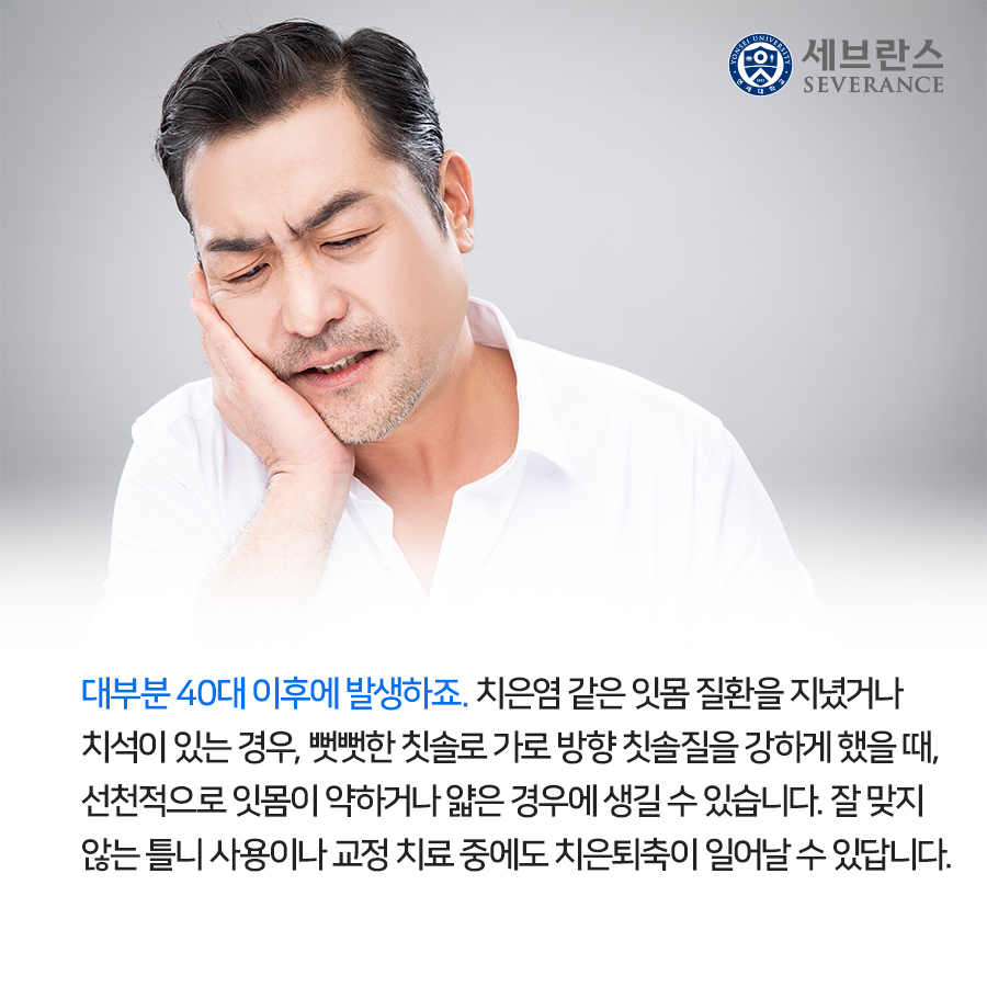 대부분 40대 이후에 발생하죠. 치은염 같은 잇몸 질환을 지녔거나 치석이 있는 경우, 뻣뻣한 칫솔로 가로 방향 칫솔질을 강하게 했을 때, 선천적으로 잇몸이 약하거나 얇은 경우에 생길 수 있습니다. 잘 맞지 않는 틀니 사용이나 교정 치료 중에도 치은퇴축이 일어날 수 있답니다.