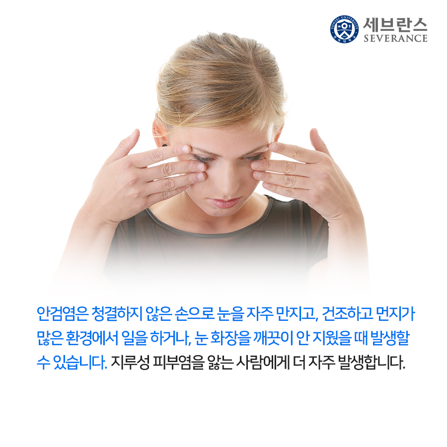 안검염은 청결하지 않은 손으로 눈을 자주 만지고, 건조하고 먼지가 많은 환경에서 일을 하거나, 눈 화장을 깨끗이 안 지웠을 때 발생할 수 있습니다. 지루성 피부염을 앓는 사람에게 더 자주 발생합니다.