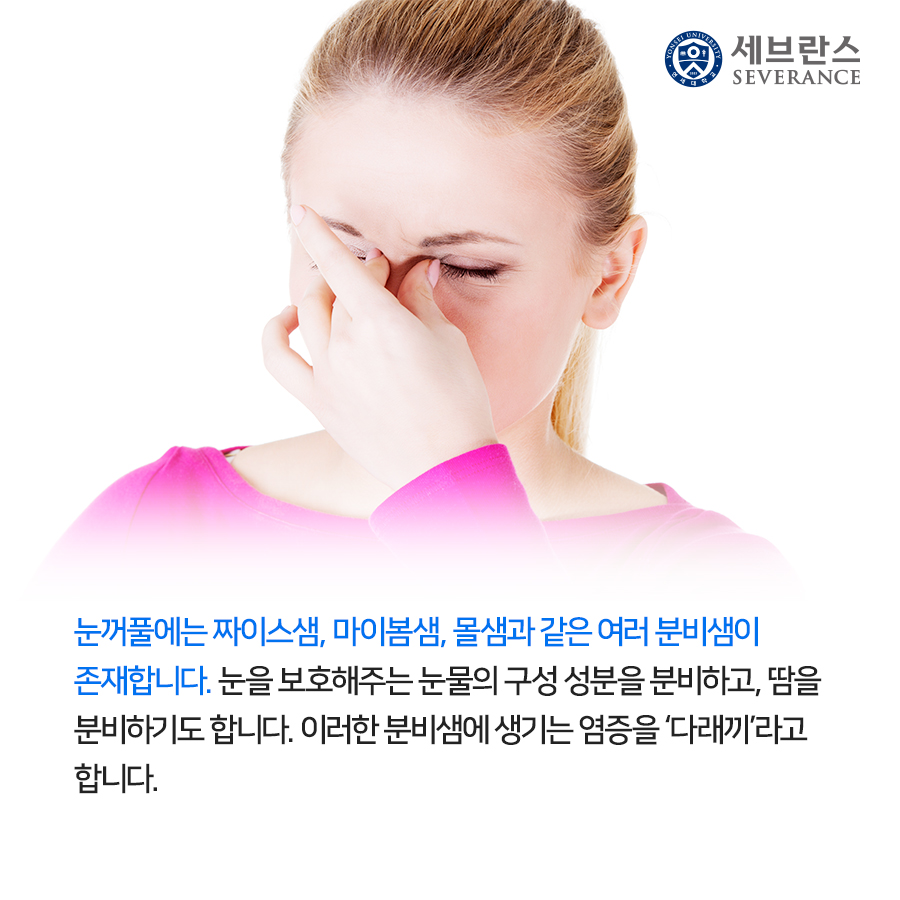 눈꺼풀에는 짜이스샘, 마이봄샘, 몰샘과 같은 여러 분비샘이 존재합니다. 눈을 보호해주는 눈물의 구성 성분을 분비하고, 땀을 분비하기도 합니다. 이러한 분비샘에 생기는 염증을 ‘다래끼’라고 합니다.