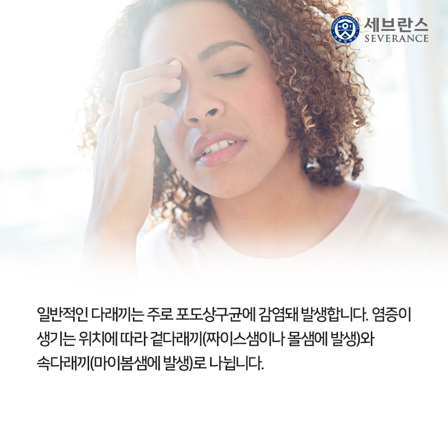 일반적인 다래끼는 주로 포도상구균에 감염돼 발생합니다. 염증이 생기는 위치에 따라 겉다래끼(짜이스샘이나 몰샘에 발생)와 속다래끼(마이봄샘에 발생)로 나뉩니다. 