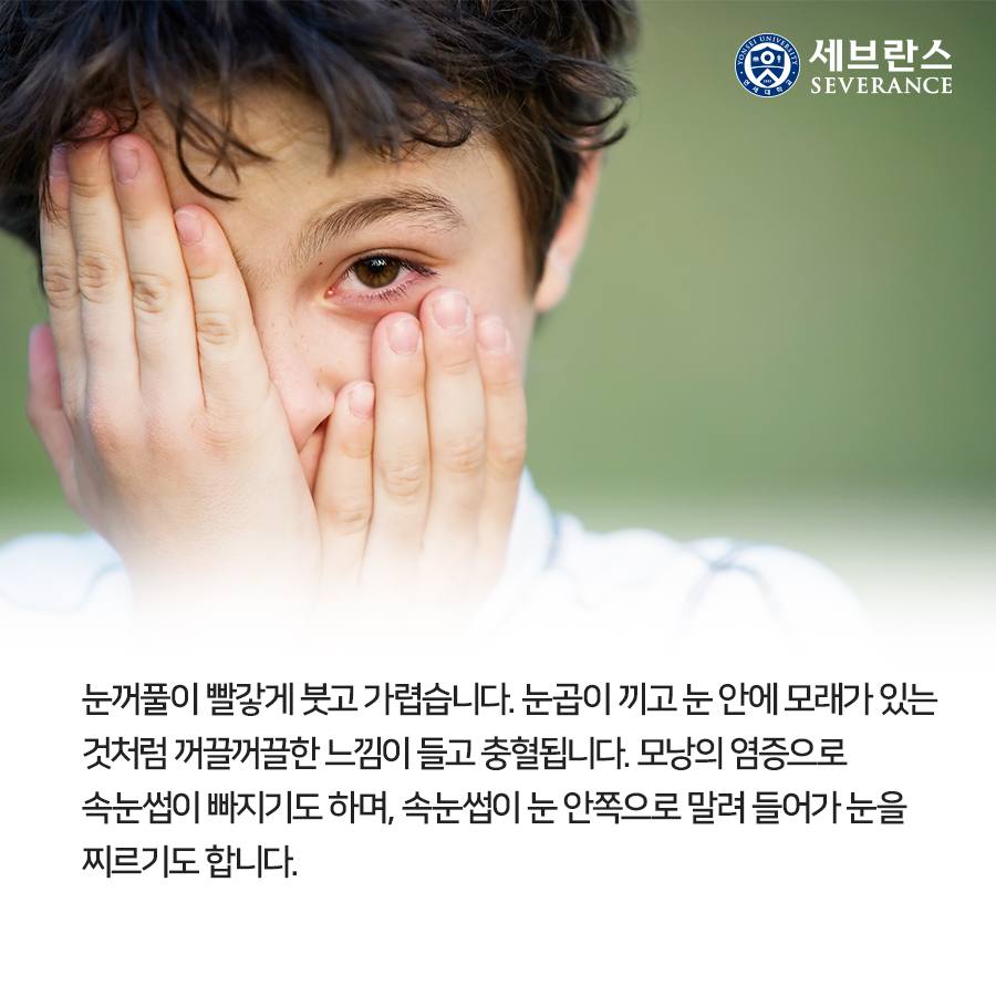 눈꺼풀이 빨갛게 붓고 가렵습니다. 눈곱이 끼고 눈 안에 모래가 있는 것처럼 꺼끌꺼끌한 느낌이 들고 충혈됩니다. 모낭의 염증으로 속눈썹이 빠지기도 하며, 속눈썹이 눈 안쪽으로 말려 들어가 눈을 찌르기도 합니다.