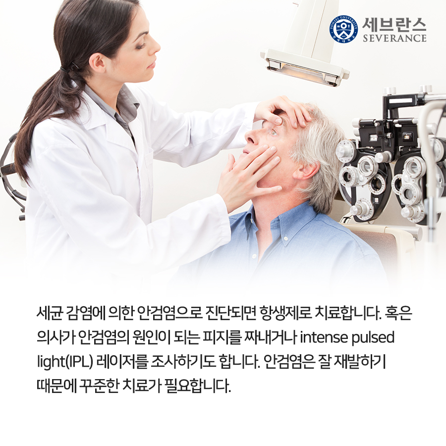 세균 감염에 의한 안검염으로 진단되면 항생제로 치료합니다. 혹은 의사가 안검염의 원인이 되는 피지를 짜내거나 intense pulsed light(IPL) 레이저를 조사하기도 합니다. 안검염은 잘 재발하기 때문에 꾸준한 치료가 필요합니다.