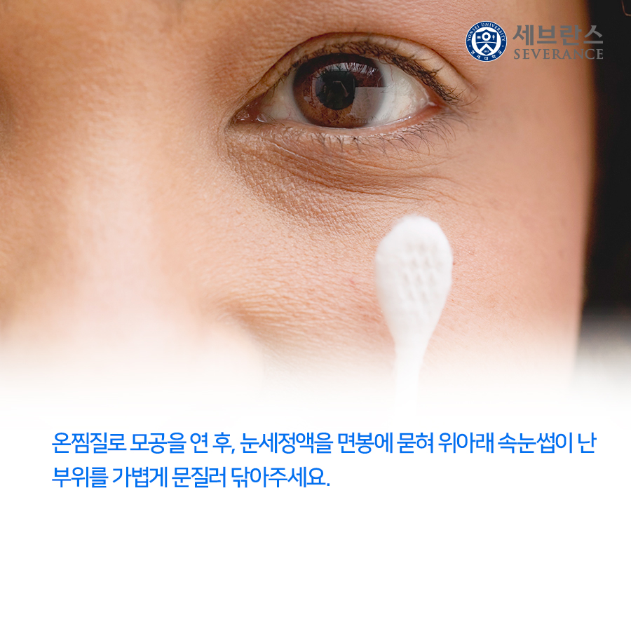 온찜질로 모공을 연 후, 눈세정액을를 면봉에 묻혀 위아래 속눈썹이 난 부위를 가볍게 문질러 닦아주세요.