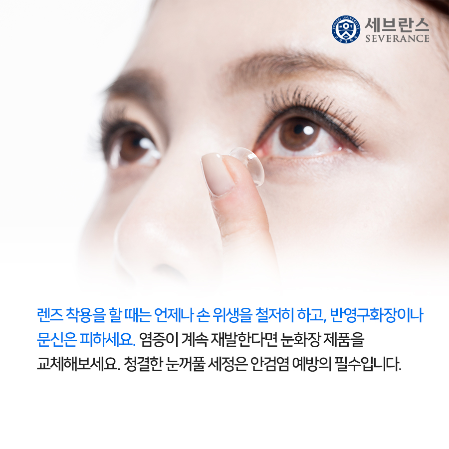 렌즈 착용을 할 때는 언제나 손 위생을 철저히 하고, 반영구화장이나 문신은 피하세요. 염증이 계속 재발한다면 눈화장 제품을 교체해보세요. 청결한 눈꺼풀 세정은 안검염 예방의 필수입니다.