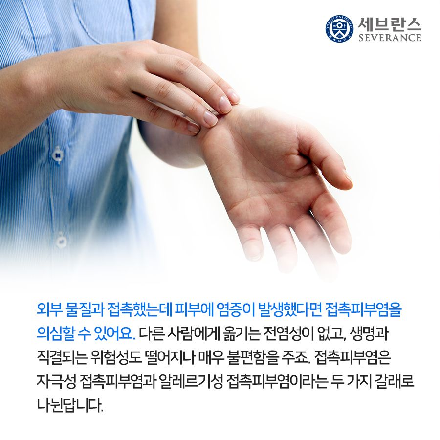 외부 물질과 접촉했는데 피부에 염증이 발생했다면 접촉피부염을 의심할 수 있어요. 전염성이 없고, 생명과 직결되는 위험성도 떨어지나 매우 불편함을 주죠. 접촉피부염은 자극성 접촉피부염과 알레르기성 접촉피부염이라는 두 가지 갈래로 나뉜답니다.
