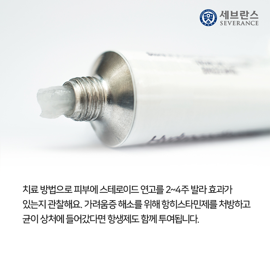 치료 방법으로 피부에 스테로이드 연고를 2~4주 발라 효과가 있는지 관찰해요. 가려움증 해소를 위해 항히스타민제를 처방하고 균이 상처에 들어갔다면 항생제도 함께 투여됩니다.