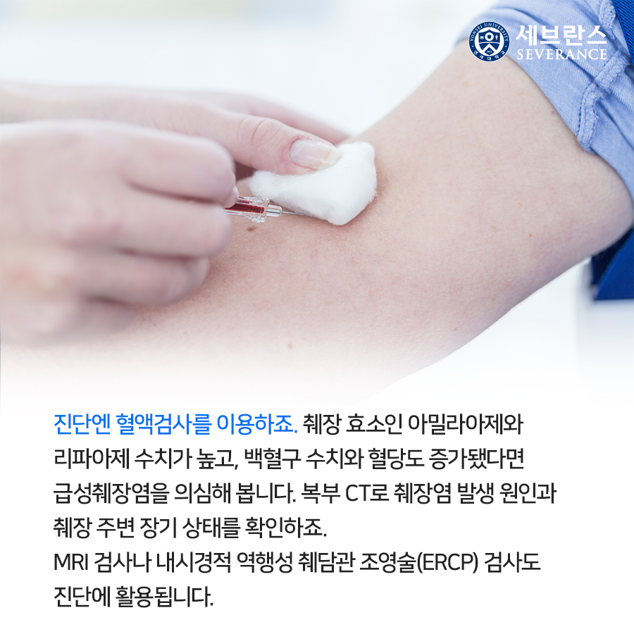 진단엔 혈액검사를 이용하죠. 췌장 효소인 아밀라아제와 리파아제 수치가 높고, 백혈구 수치와 혈당도 증가됐다면 급성췌장염을 의심해 봅니다. 복부 CT로 췌장염 발생 원인과 췌장 주변 장기 상태를 확인하죠.   MRI 검사나 내시경적 역행성 췌담관 조영술(ERCP) 검사도 진단에 활용됩니다.