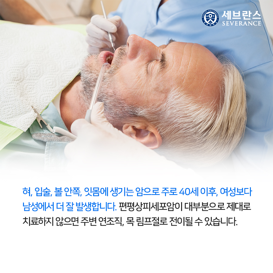 혀, 입술, 볼 안쪽, 잇몸에 생기는 암으로 주로 40세 이후, 여성보다 남성에서 더 잘 발생합니다. 편평상피세포암이 대부분으로 제대로 치료하지 않으면 주변 연조직, 목 림프절로 전이될 수 있습니다.
