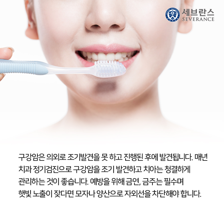 구강암은 의외로 조기발견을 못 하고 진행된 후에 발견됩니다. 매년 치과 정기검진으로 구강암을 조기 발견하고 치아는 청결하게 관리하는 것이 좋습니다. 예방을 위해 금연, 금주는 필수며 햇빛 노출이 잦다면 모자나 양산으로 자외선을 차단해야 합니다.
