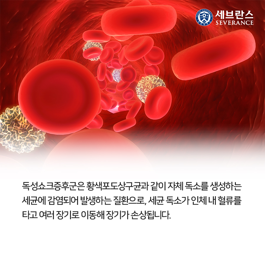 독성쇼크증후군은 황색포도상구균과 같이 자체 독소를 생성하는 세균에 감염되어 발생하는 질환으로, 세균 독소가 인체 내 혈류를 타고 여러 장기로 이동해 장기가 손상됩니다. 