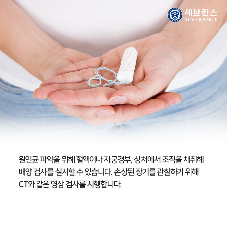 원인균 파악을 위해 혈액이나 자궁경부, 상처에서 조직을 채취해 배양 검사를 실시할 수 있습니다. 손상된 장기를 관찰하기 위해 CT와 같은 영상 검사를 시행합니다.