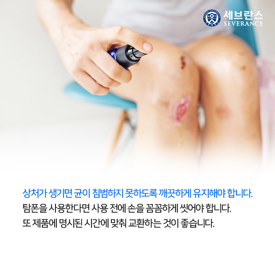 상처가 생기면 균이 침범하지 못하도록 깨끗하게 유지해야 합니다. 탐폰을 사용한다면 사용 전에 손을 꼼꼼하게 씻어야 합니다. 또 제품에 명시된 시간에 맞춰 교환하는 것이 좋습니다. 