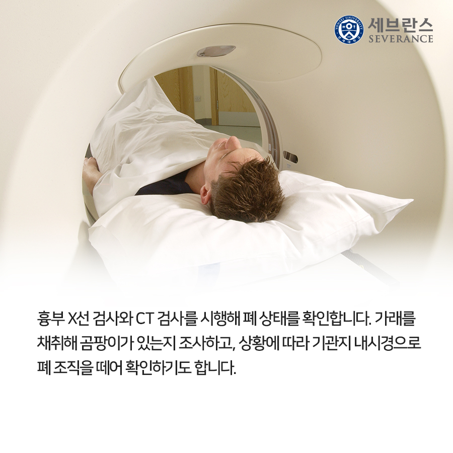 흉부 X선 검사와 CT 검사를 시행해 폐 상태를 확인합니다. 가래를 채취해 곰팡이가 있는지 조사하고, 상황에 따라 기관지 내시경으로 폐 조직을 떼어 확인하기도 합니다.