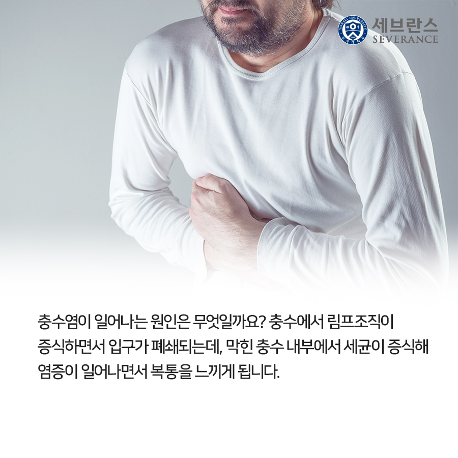 충수염이 일어나는 원인은 무엇일까요? 충수에서 림프조직이 증식하면서 입구가 폐쇄되는데, 막힌 충수 내부에서 세균이 증식해 염증이 일어나면서 복통을 느끼게 됩니다.