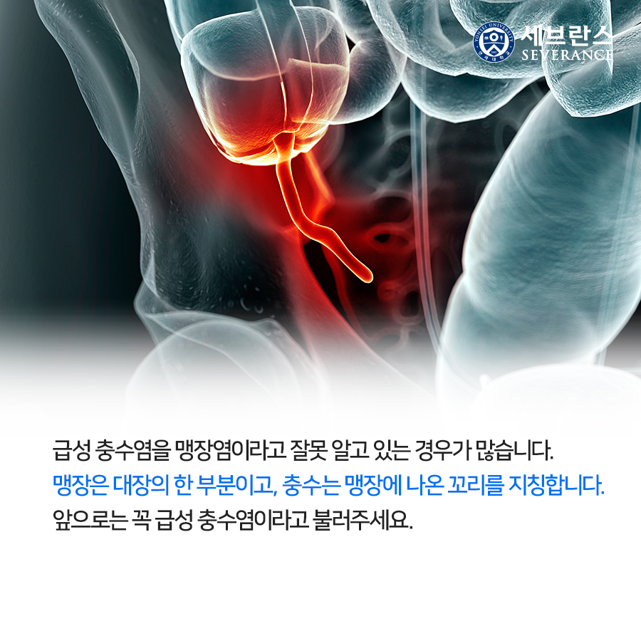 급성 충수염을 맹장염이라고 잘못 알고 있는 경우가 많습니다. 맹장은 대장의 한 부분이고, 충수는 맹장에 나온 꼬리를 지칭합니다. 앞으로는 꼭 급성 충수염이라고 불러주세요.