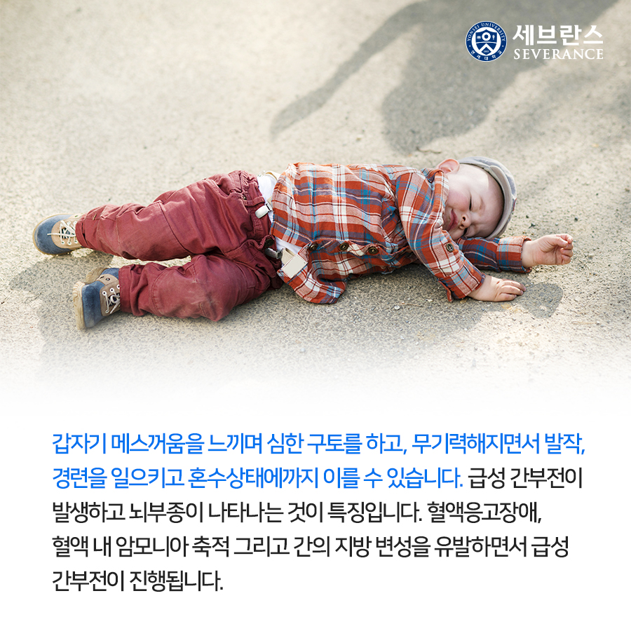 갑자기 메스꺼움을 느끼며 심한 구토를 하고, 무기력해지면서 발작, 경련을 일으키고 혼수상태에까지 이를 수 있습니다. 급성 간부전이 발생하고 뇌부종이 나타나는 것이 특징입니다. 혈액응고장애, 혈액 내 암모니아 축적 그리고 간의 지방 변성을 유발하면서 급성 간부전이 진행됩니다. 