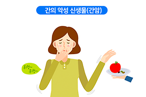 간의 악성 신생물(간암)